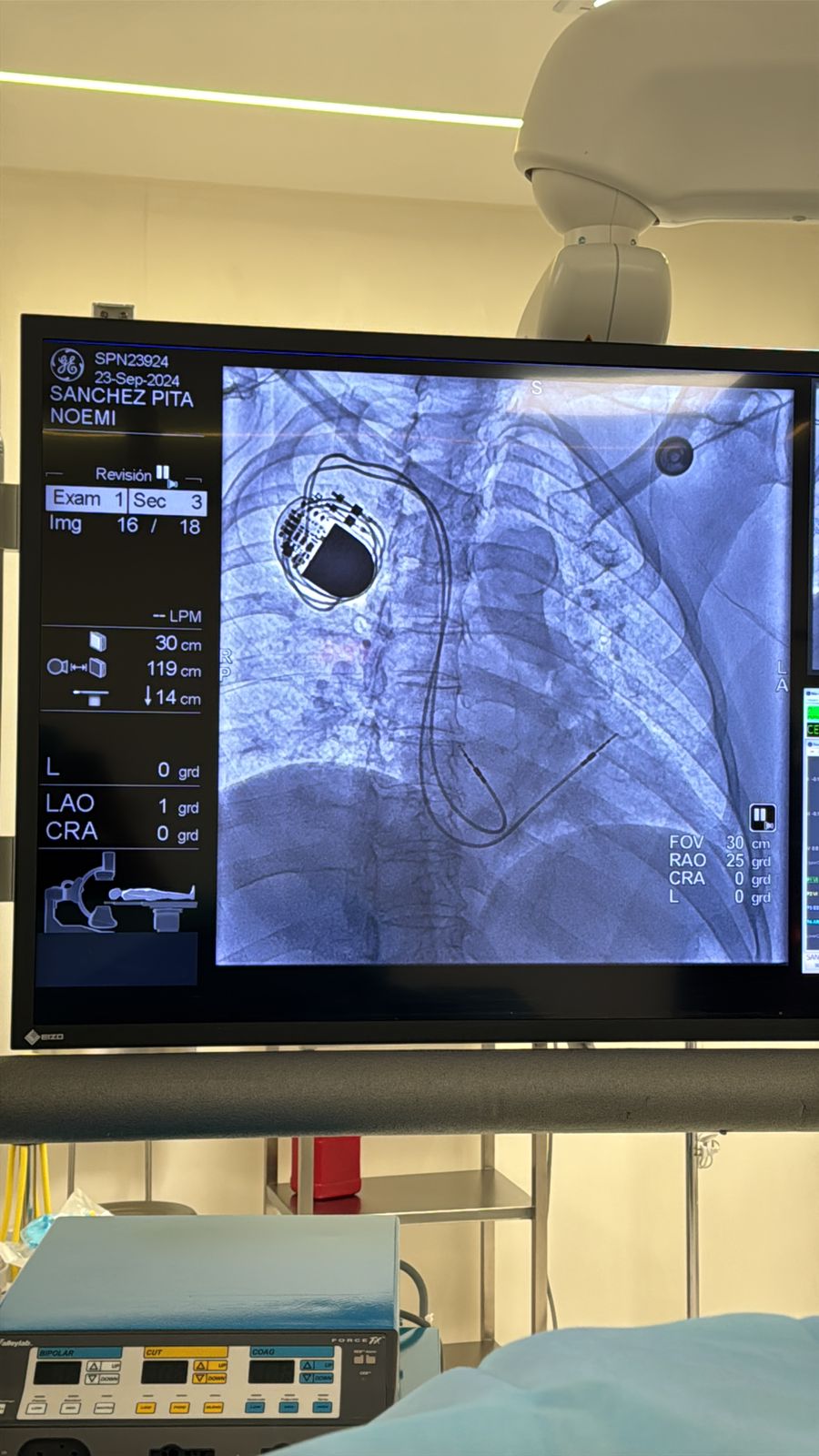 Valoración Preoperatoria